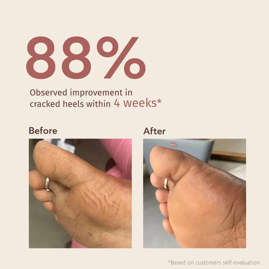 Vilvah Foot Care Cream 100ml