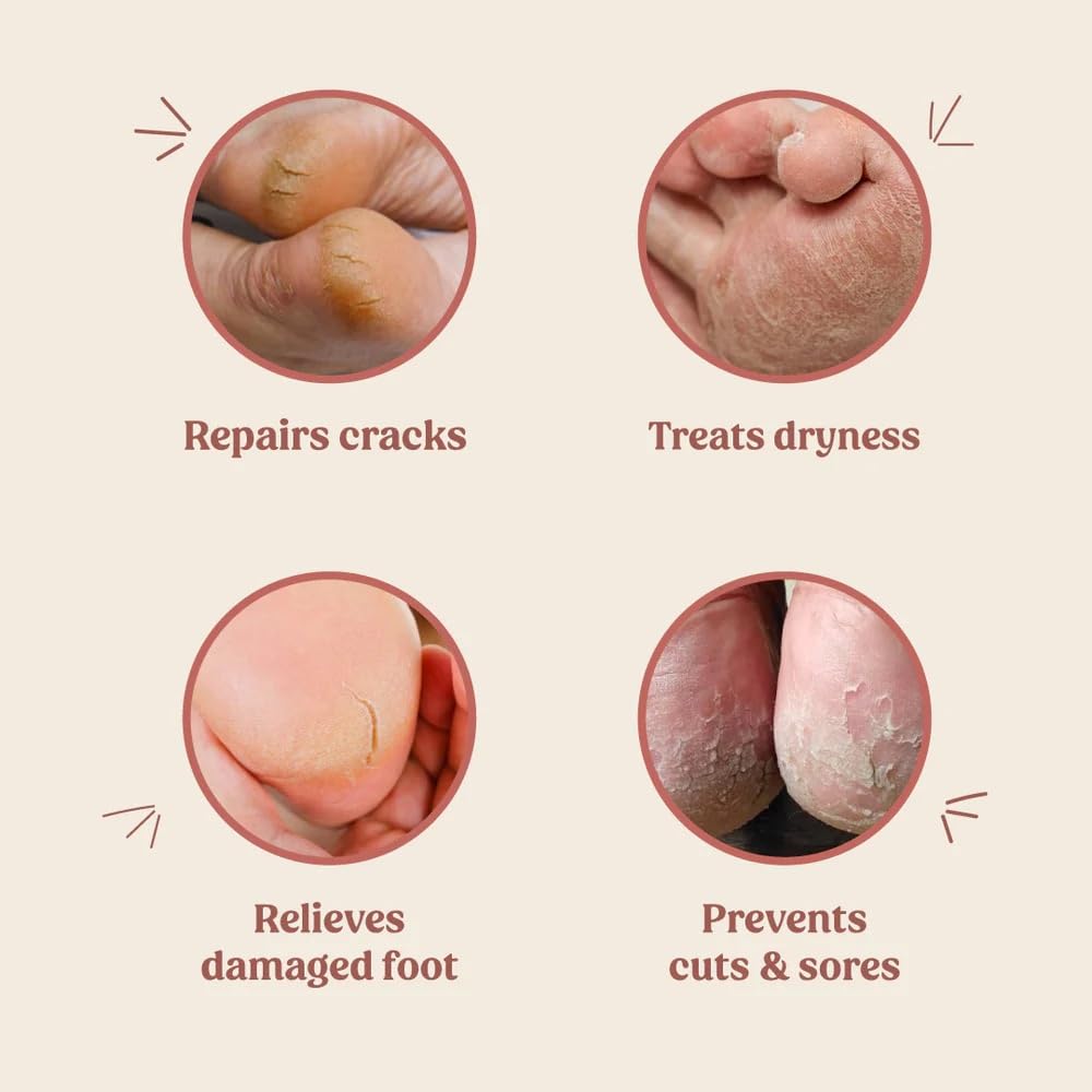 Vilvah Foot Care Cream 100ml