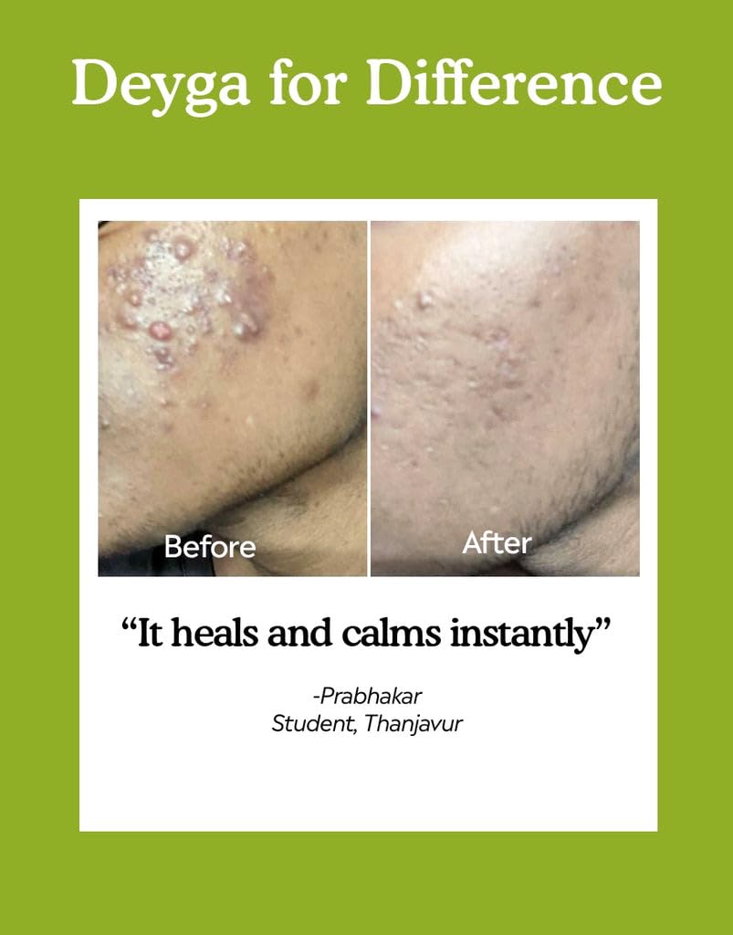 Deyga Pure Aloe Vera Gel 100 g