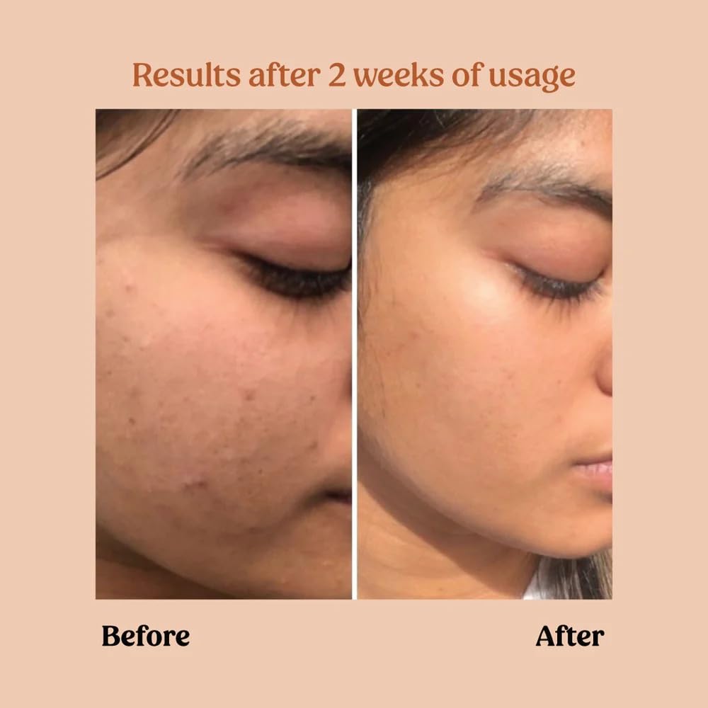 Vilvah Face Brightening Kit