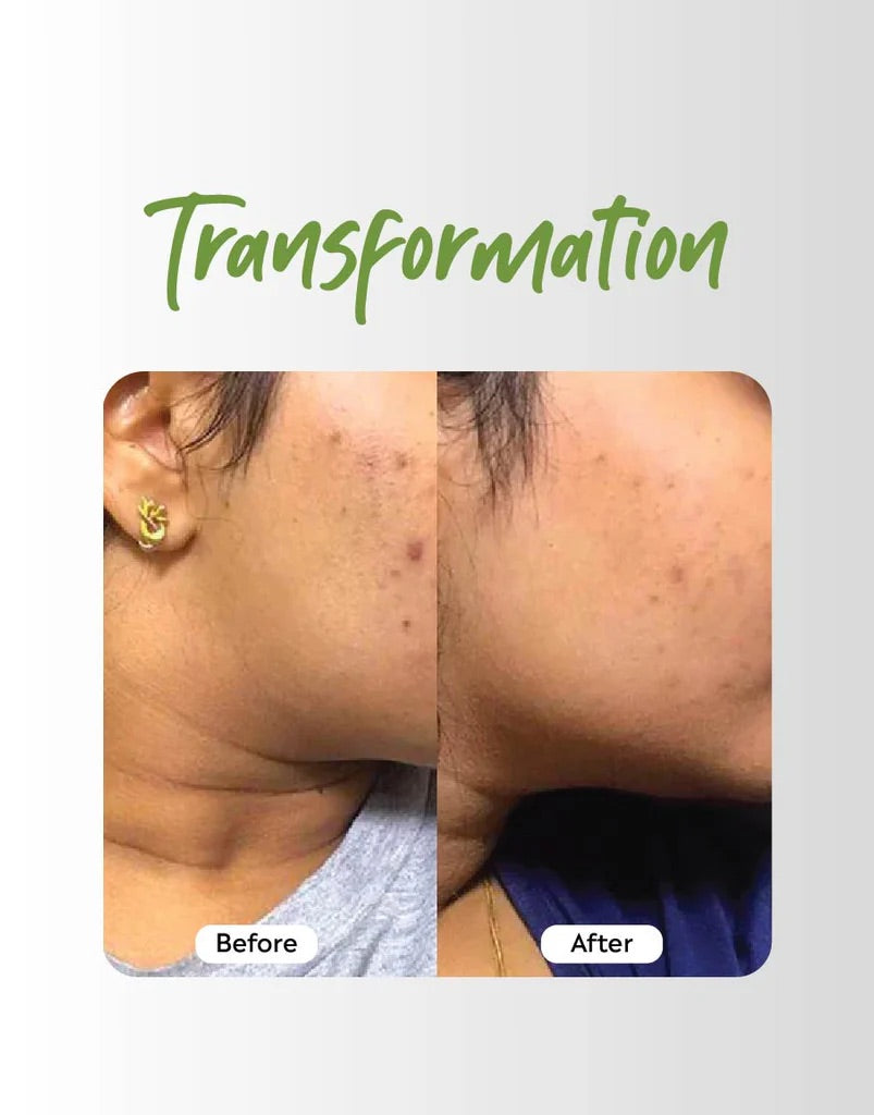 Deyga Clear Skin Kit