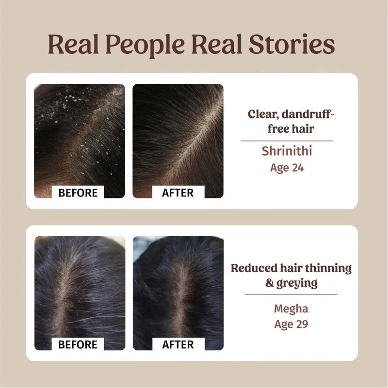 Vilvah Anti-Dandruff Haircare Kit