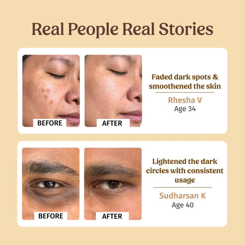 Vilvah Face Lift Kit