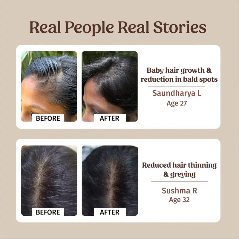 Vilvah Hairfall Control Kit