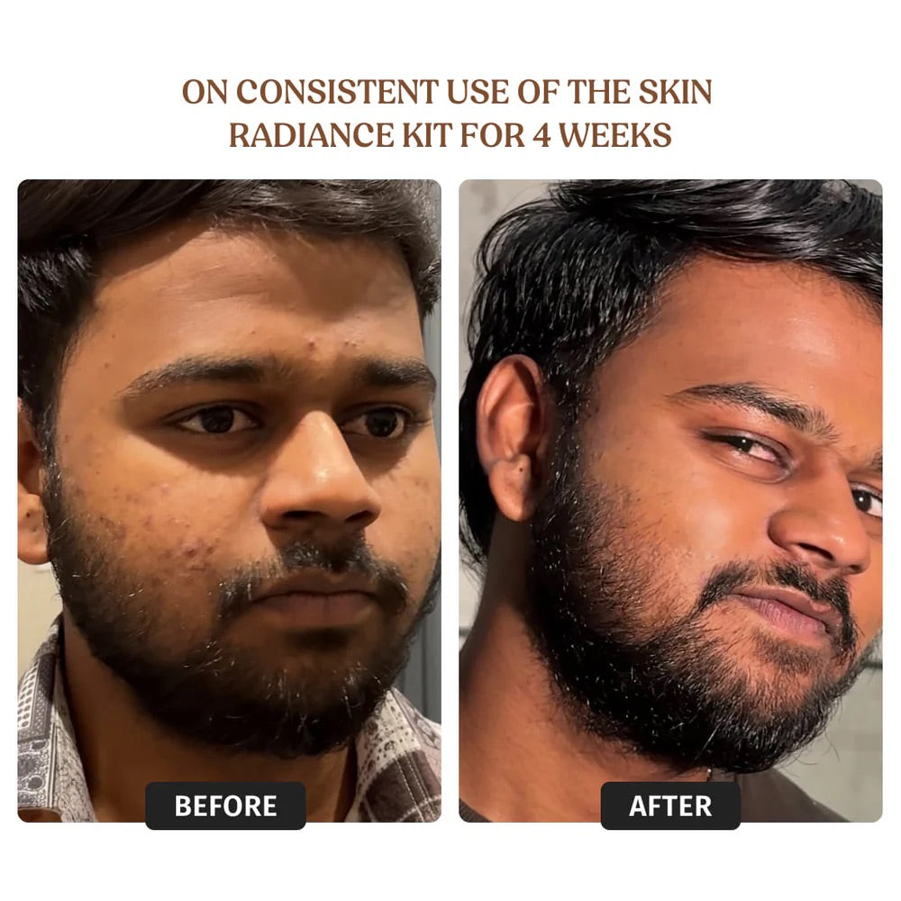 Vilvah Skin Radiance Large Kit