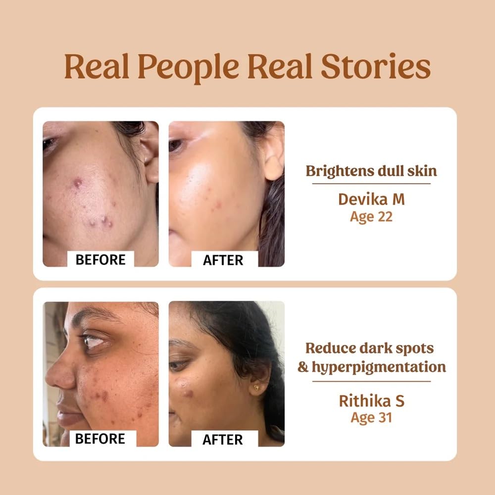 Vilvah Milk Drops Brightening Serum 40 ml