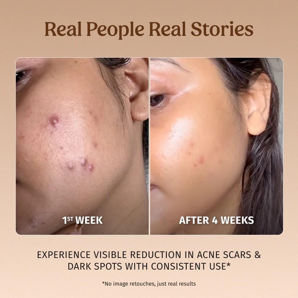 Vilvah Milk Drops Brightening Serum 40 ml