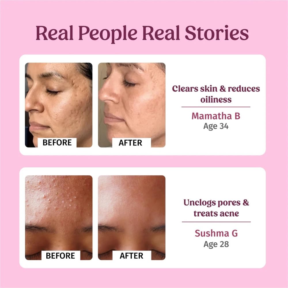 Vilvah Rosewater Facial Toner 100ml