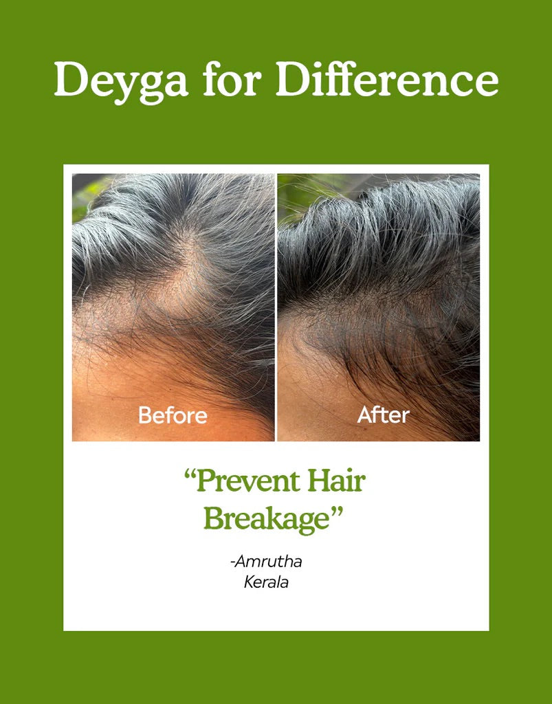 Deyga Hair Growth Oil 100 ml – customer before-and-after photo